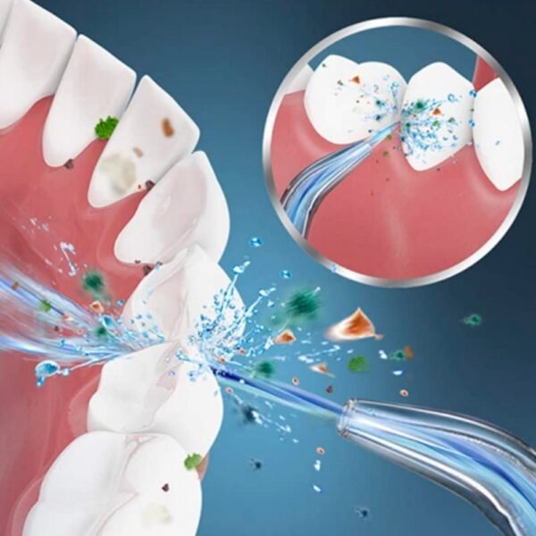Oral Irrigator - Image 3