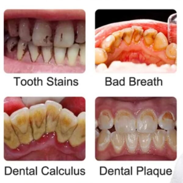 Electric Teeth Cleaner - Image 4